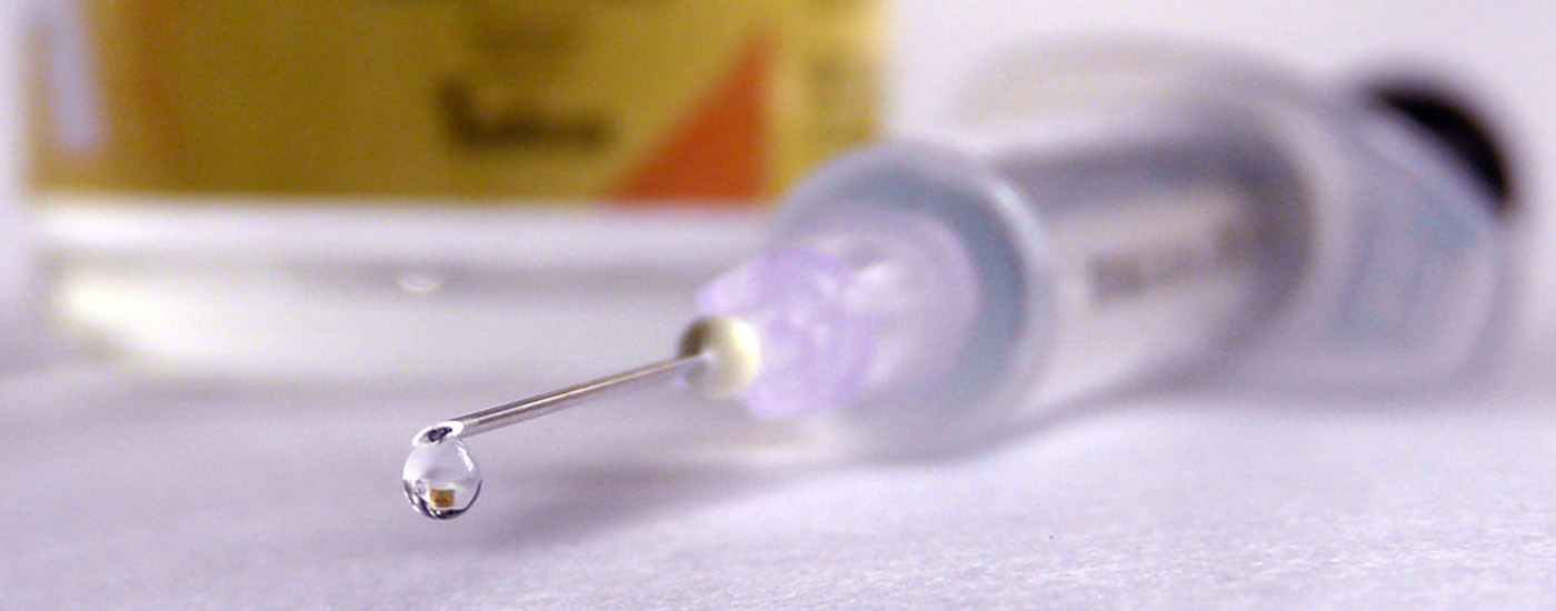 epidurale